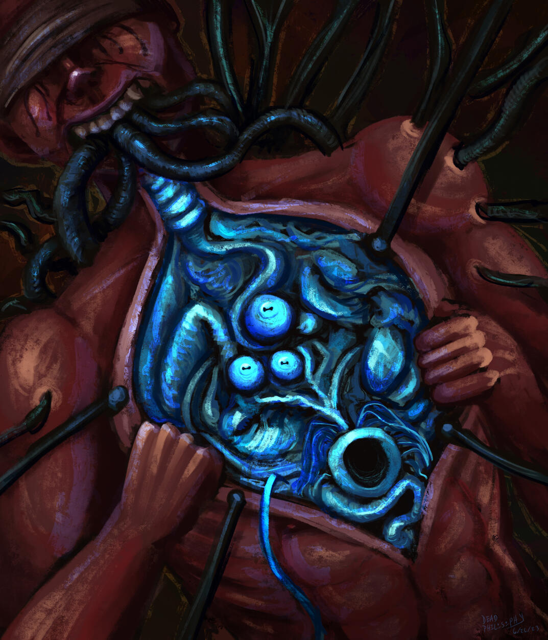 &quot;Xenotransplantation&quot; - digital